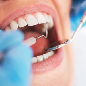 Choc : 54% des Français négligent leur santé dentaire depuis français consulte dentiste