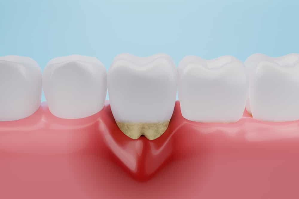 Anneau De Dentition En Bois Naturel Pour Bébé - Lot De 5 Formes (éléphant, Pingouin...)