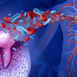 ALERTE ! Bactérie P. gingivalis : risque accru de crise p gingivalis cardiaque