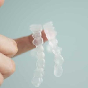 SmileDirectClub FERMETURE: Patients choqués par goût amer! Découvrez pourquoi! smiledirectclub-fermeture-patients