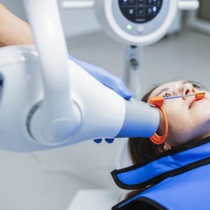 ADA révèle des changements majeurs pour les radiographies dentaires: découvrez-les! radiographie dentaire recommandations ada