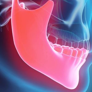 Choc Total: L'occlusion affecte tout votre corps - Les secrets occlusion