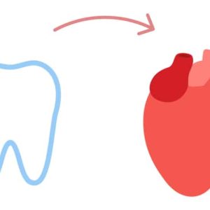 ALERTE: Nouvelles recommandations dentaires pour prévenir l'endocardite infectieuse! dentaire endocardite infectieuse has